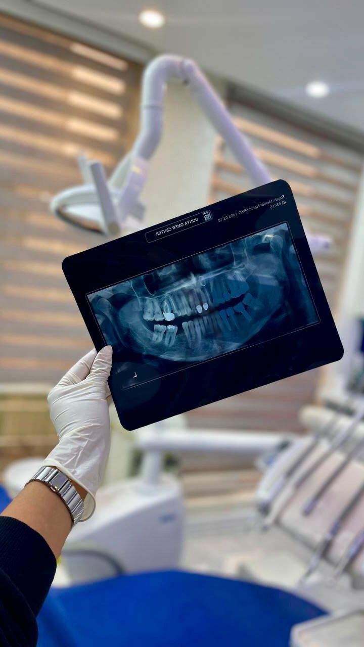 Atención dental profesional en Nezahualcóyotl